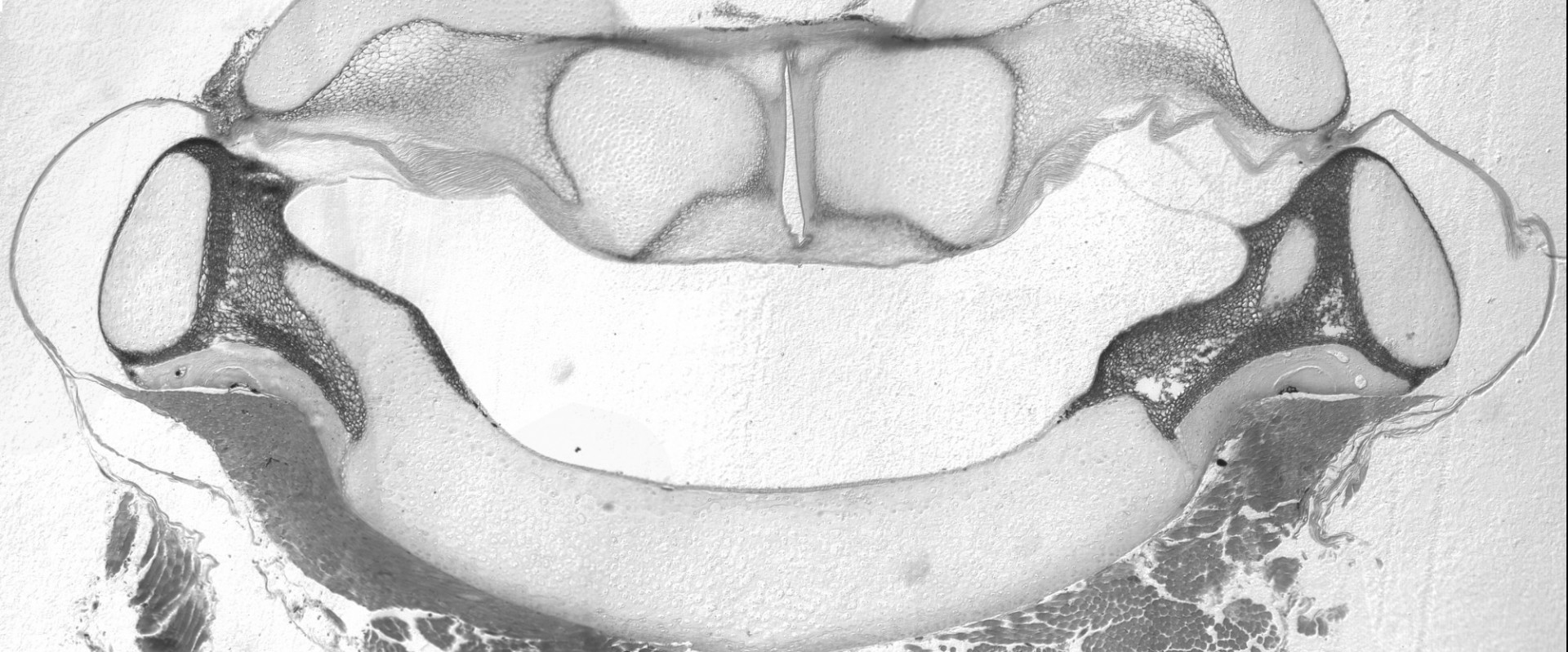 A grayscale image of a larynx cross section